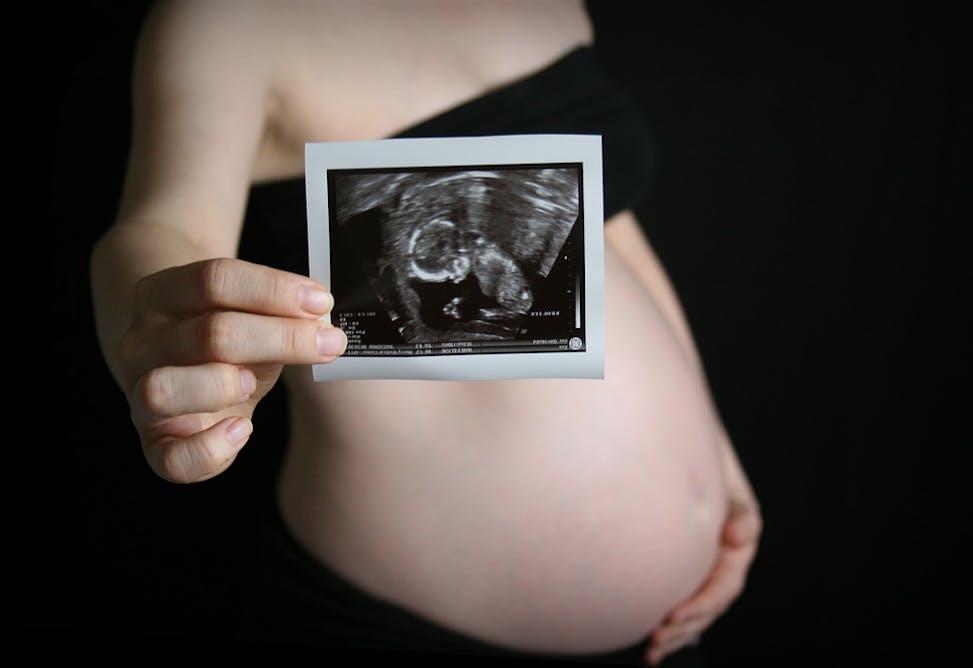 Токсикоз на 11 неделе. УЗИ ребенка в животе. 31нидел беременности УЗИ.