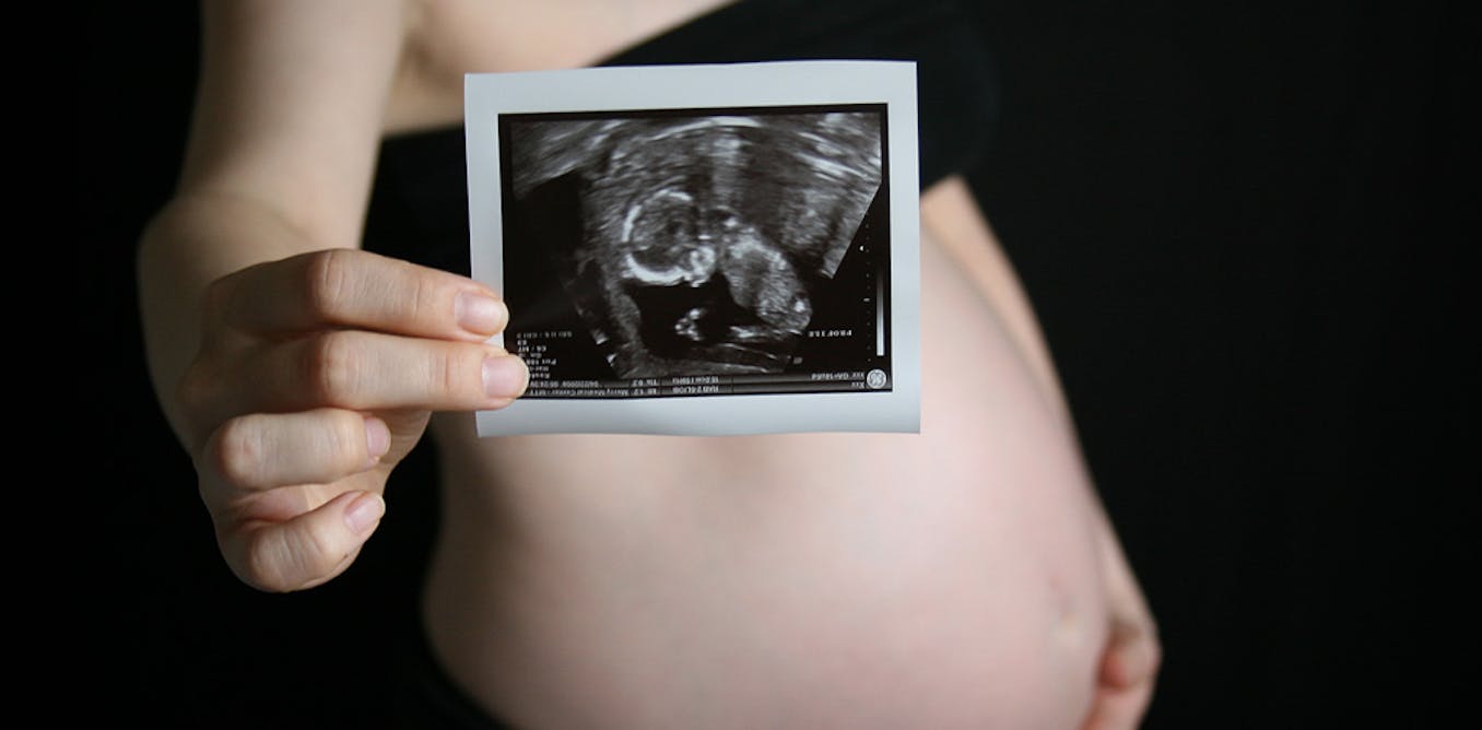 32 неделя ощущения. УЗИ ребенка в животе. 31нидел беременности УЗИ.