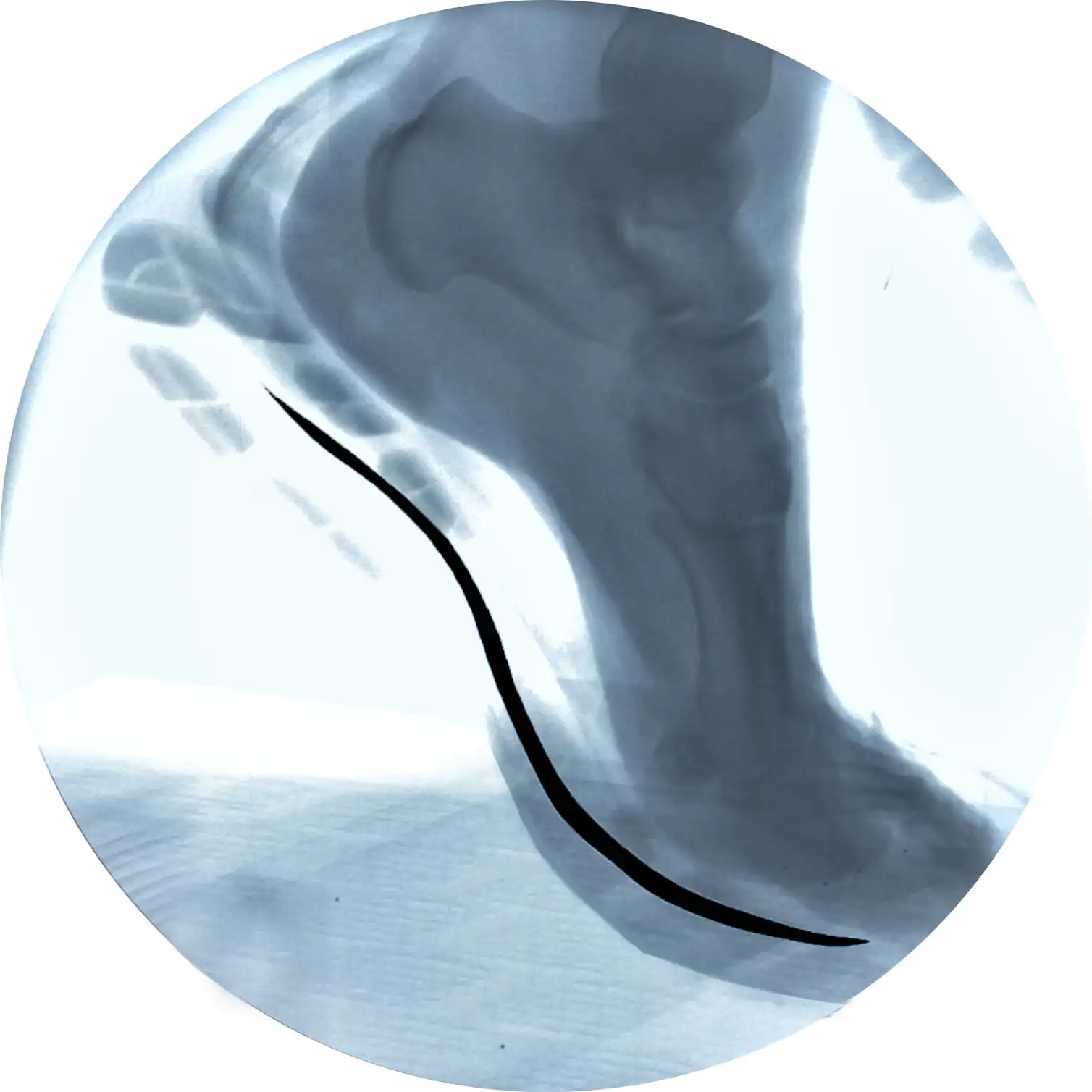 Foot Springing Beware the hype – springy soles won’t make you run much faster