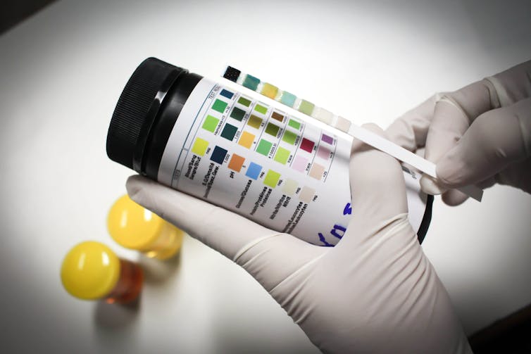 strip test pregnancy results from doctor your can what urine? your Check: Health tell strip test pregnancy results from doctor your can what urine? your Check: Health tell