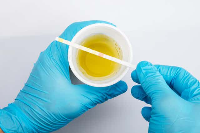 Does quick fix urine work for females