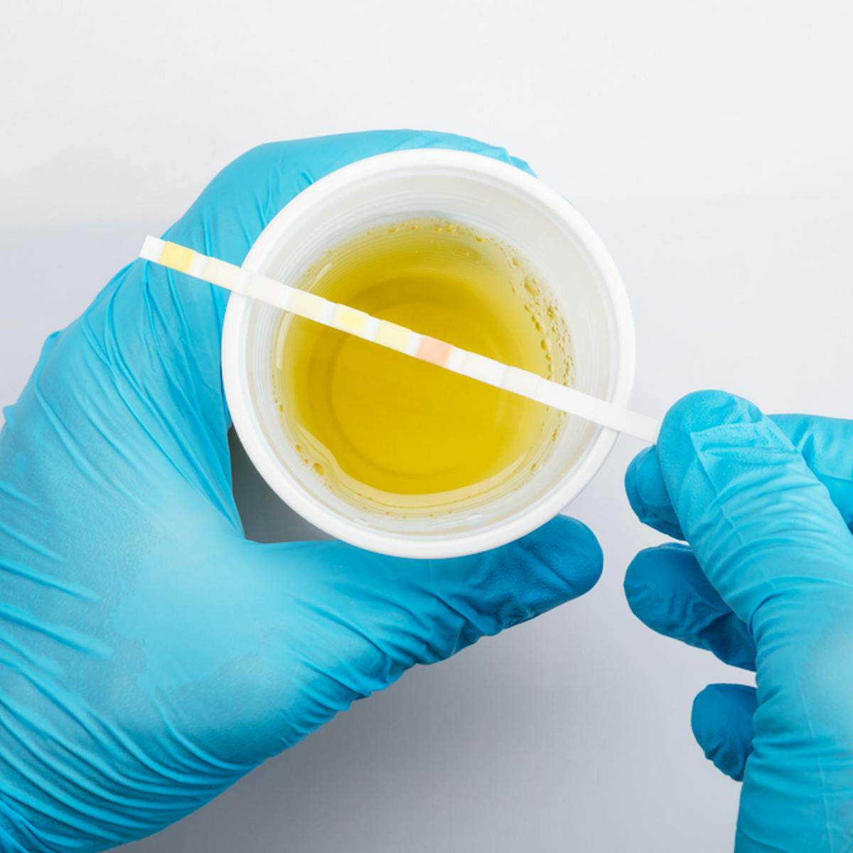 Health Check: what can your doctor tell from your urine? Health Check: what can your doctor tell from your urine?