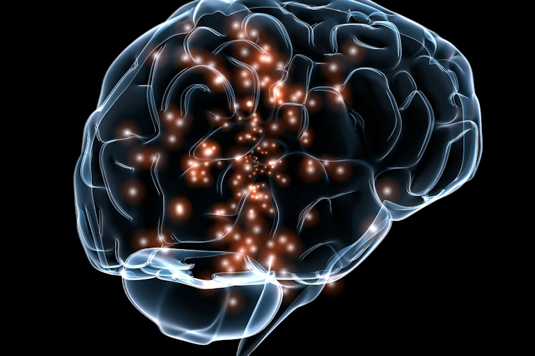 Extra Lumpy Brain Our uniquely lopsided brain