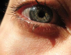 Monday S Medical Myth Chewing Gum Stops Onion Tears