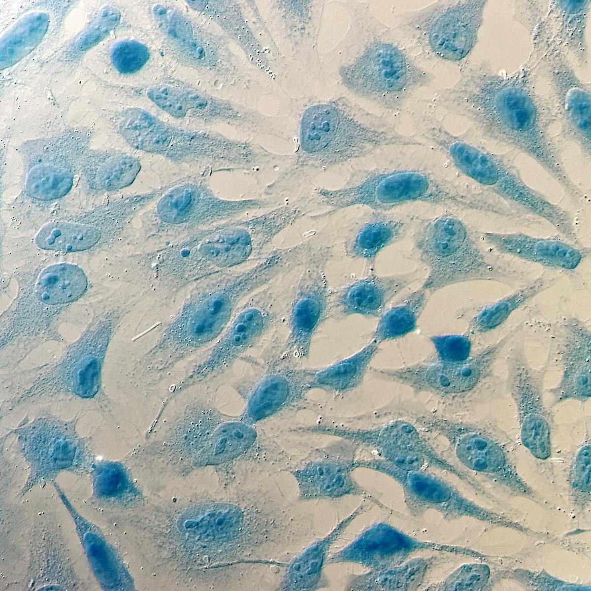 Decades On From Henrietta Lacks We Re Still Struggling To Find An Adequate Consent Model Decades On From Henrietta Lacks We Re Still Struggling To Find An Adequate Consent Model
