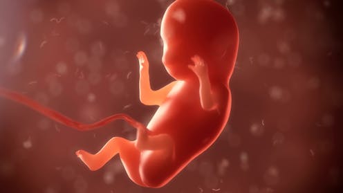 Image result for baby with birth defects in womb