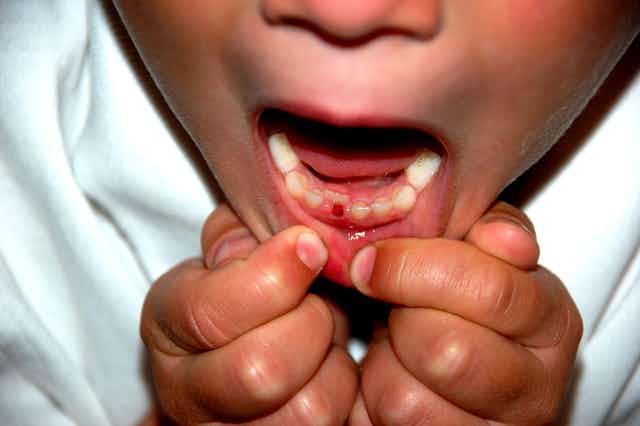Curious Kids My Tooth Fell Out Why Is It So Spiky On The Bottom Curious Kids My Tooth Fell Out Why Is It So Spiky On The Bottom