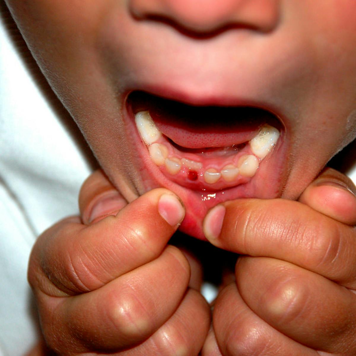 Curious Kids My Tooth Fell Out Why Is It So Spiky On The Bottom Curious Kids My Tooth Fell Out Why Is It So Spiky On The Bottom