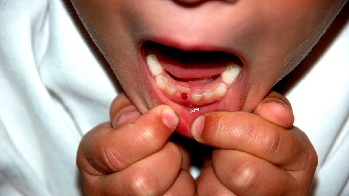 Curious Kids My Tooth Fell Out Why Is It So Spiky On The Bottom Curious Kids My Tooth Fell Out Why Is It So Spiky On The Bottom