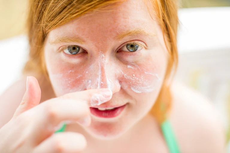 Research Check: can a new drug really protect redheads from cancer? Research Check: can a new drug really protect redheads from cancer?
