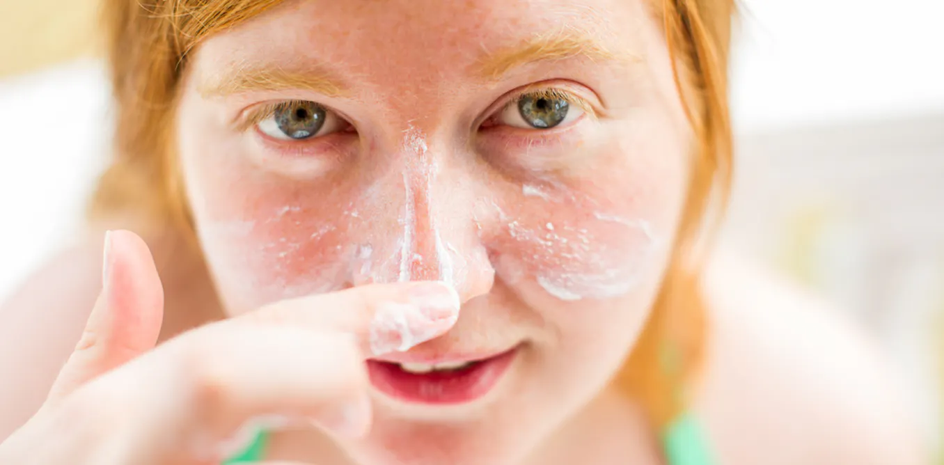 Research Check: can a new drug really protect redheads from cancer?