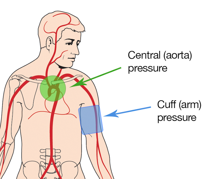 The Most Used Method Of Measuring Blood Pressure Is Often