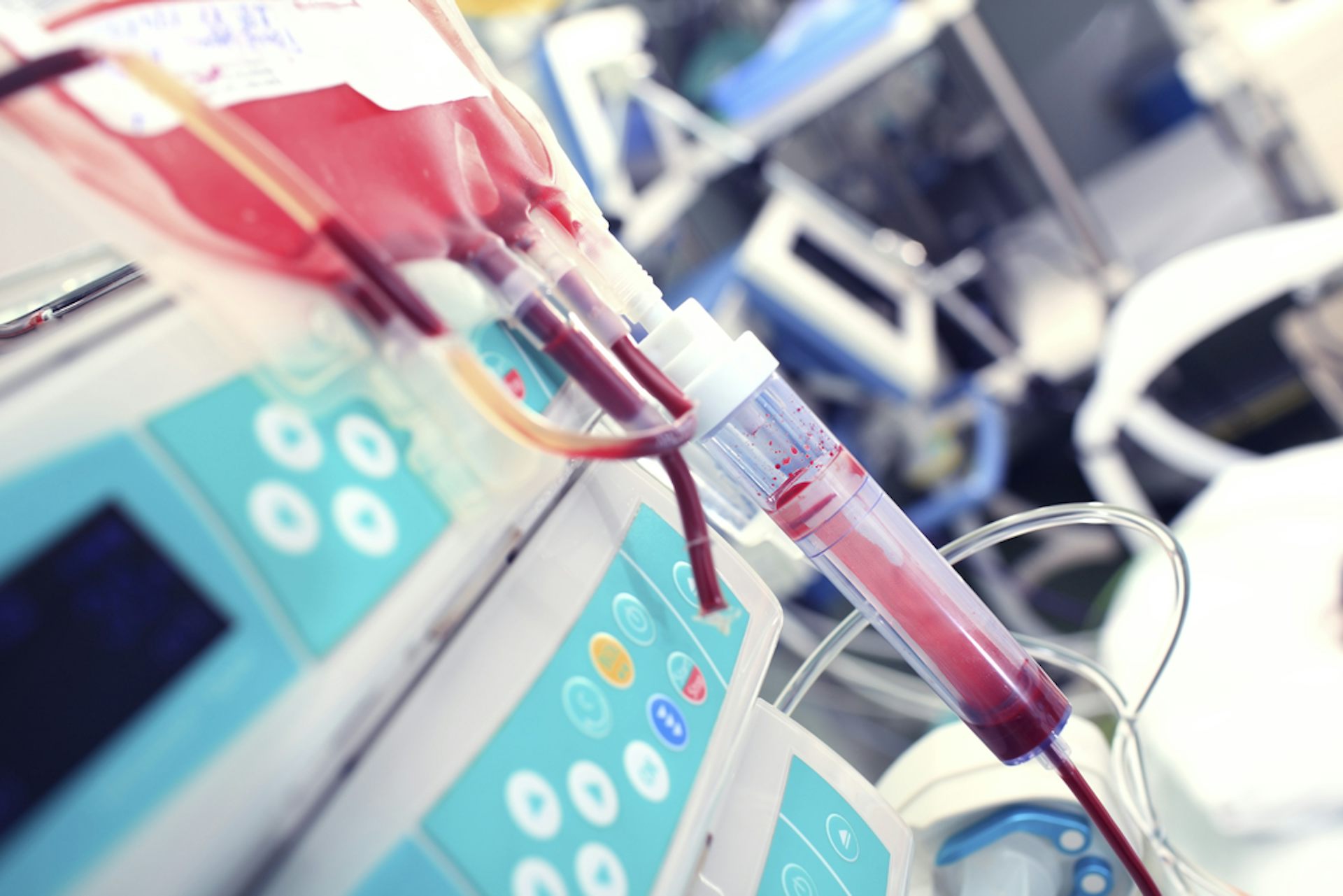 From animal experiments to saving lives a history of blood transfusions
