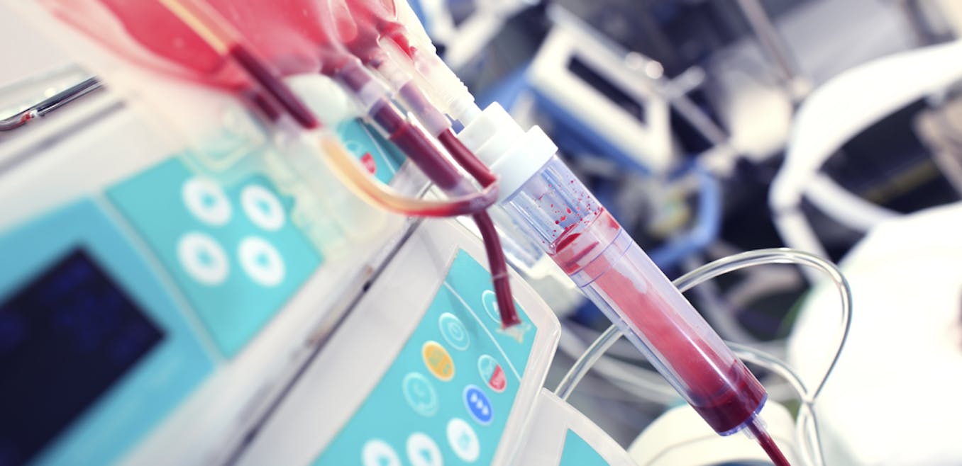 From animal experiments to saving lives: a history of blood transfusions