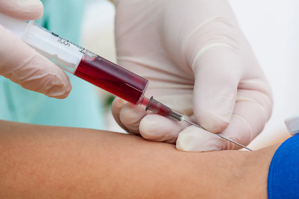 bleeding after b12 injection Vitamin and ulcerative colitis: Links and more B12 Shots in La Grange,