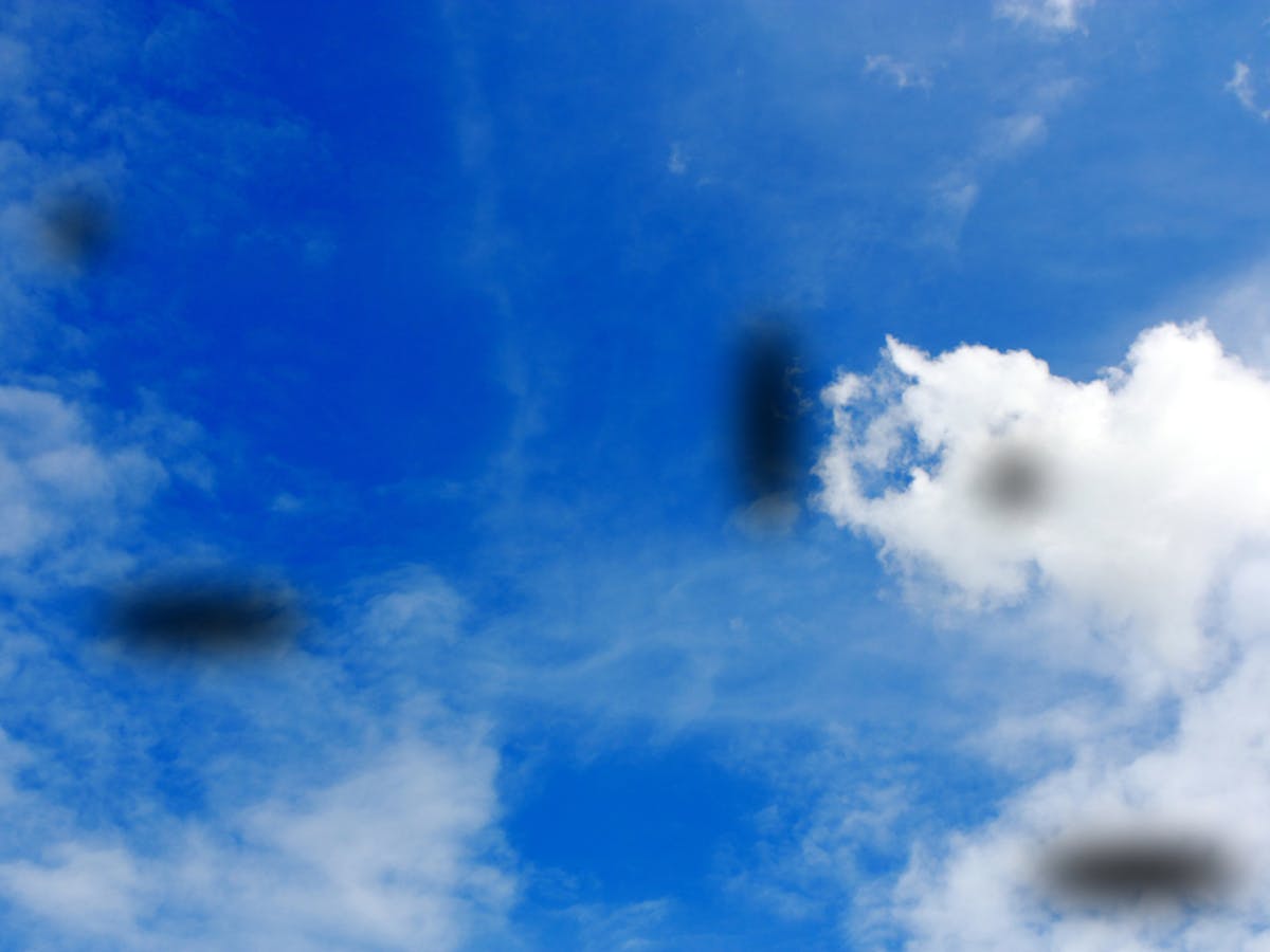 The Laser Beam That Can Get Rid Of Those Pesky Eye Floaters The Laser Beam That Can Get Rid Of Those Pesky Eye Floaters