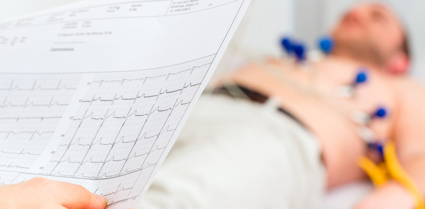 Ditching the meds: Lifestyle intervention and cardiac arrhythmia