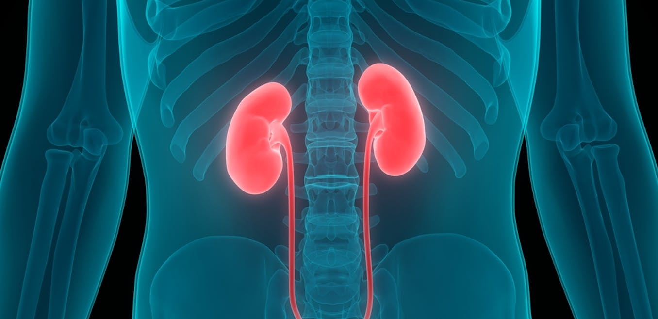 Explainer: what is chronic kidney disease and why are one in three