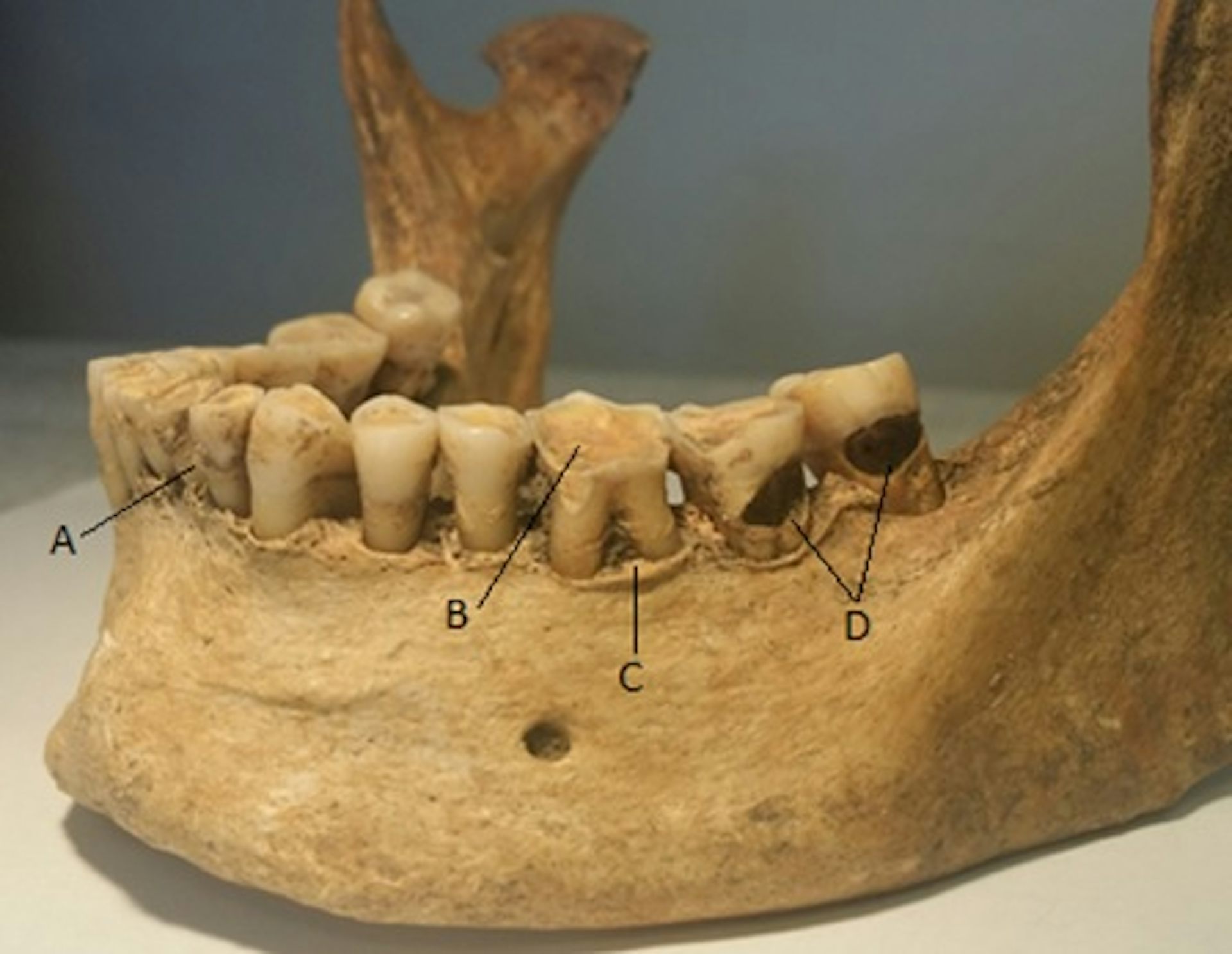 What Teeth Can Reveal About The Secret Lives Of Our Ancestors