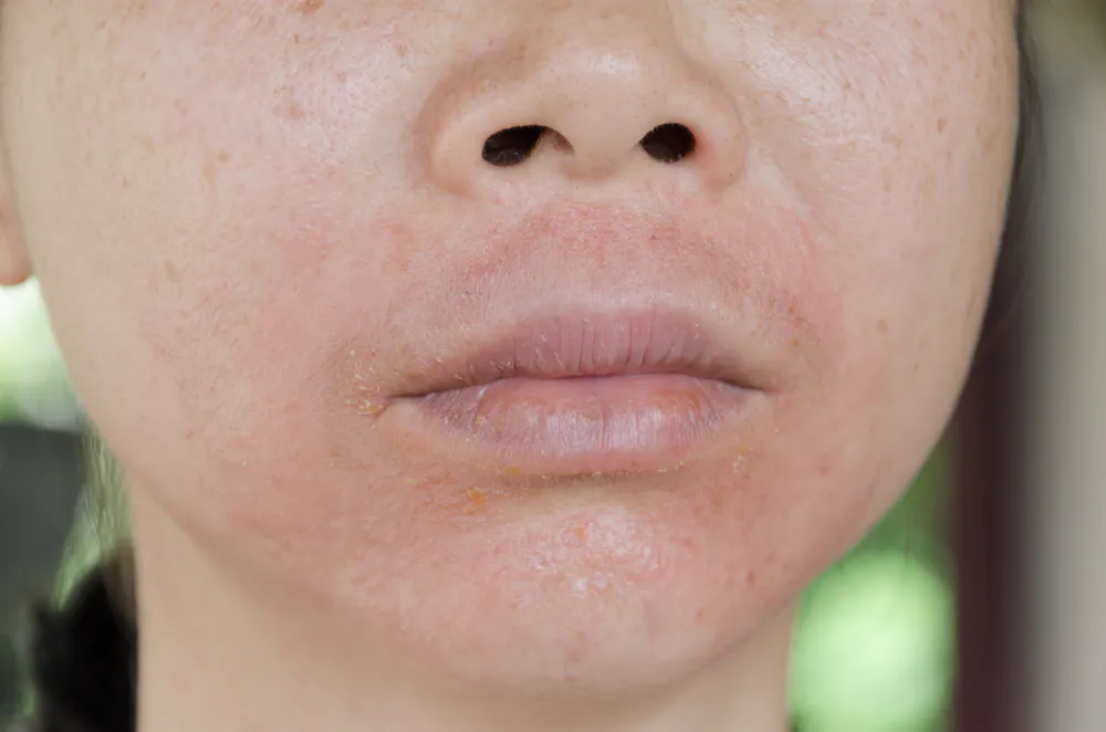 Health Check: is makeup bad for your skin?