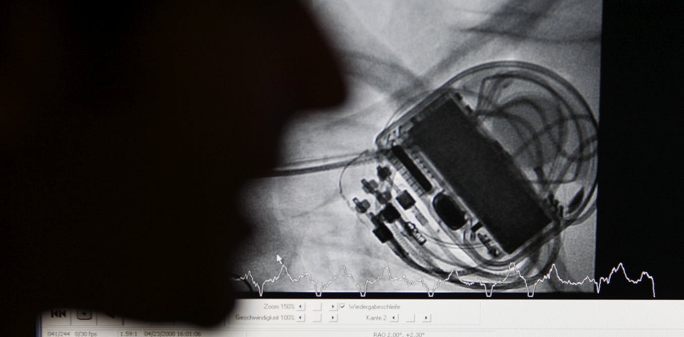 Three reasons why pacemakers are vulnerable to hacking