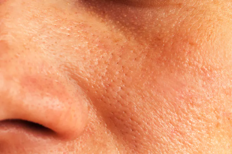 Health Check: do we have to clean out our pores?
