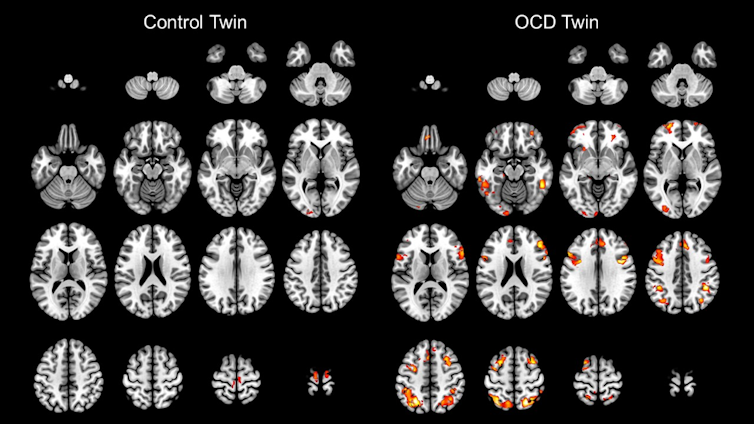 File 20171005 15464 vaswym.png?ixlib=rb 1.1