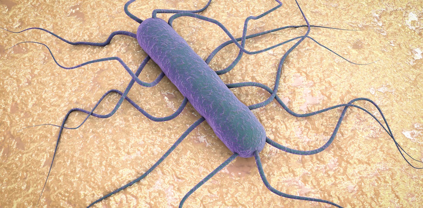 Affordable Health Care >> Spike in Listeria infections in South Africa: why it matters Affordable Health Care >> Spike in Listeria infections in South Africa: why it matters