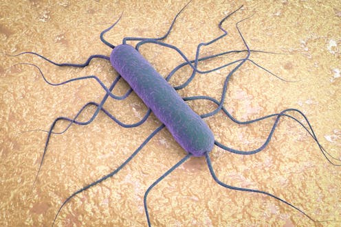 Spike in Listeria infections in South Africa: why it matters