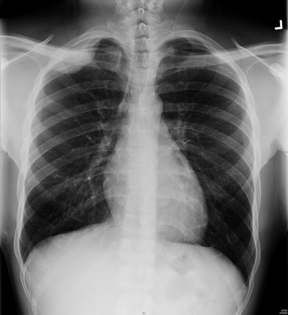 Curious Kids How Do X rays See Inside You curious-kids-how-do-x-rays-see-inside-you
