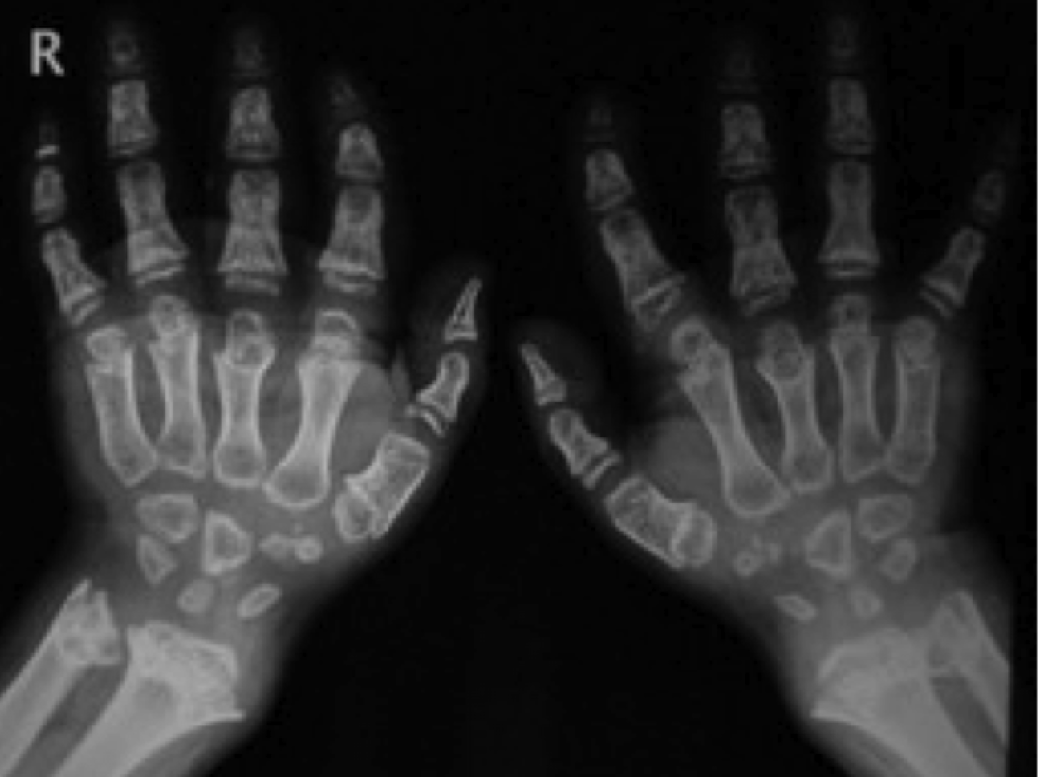 X Rays x-rays