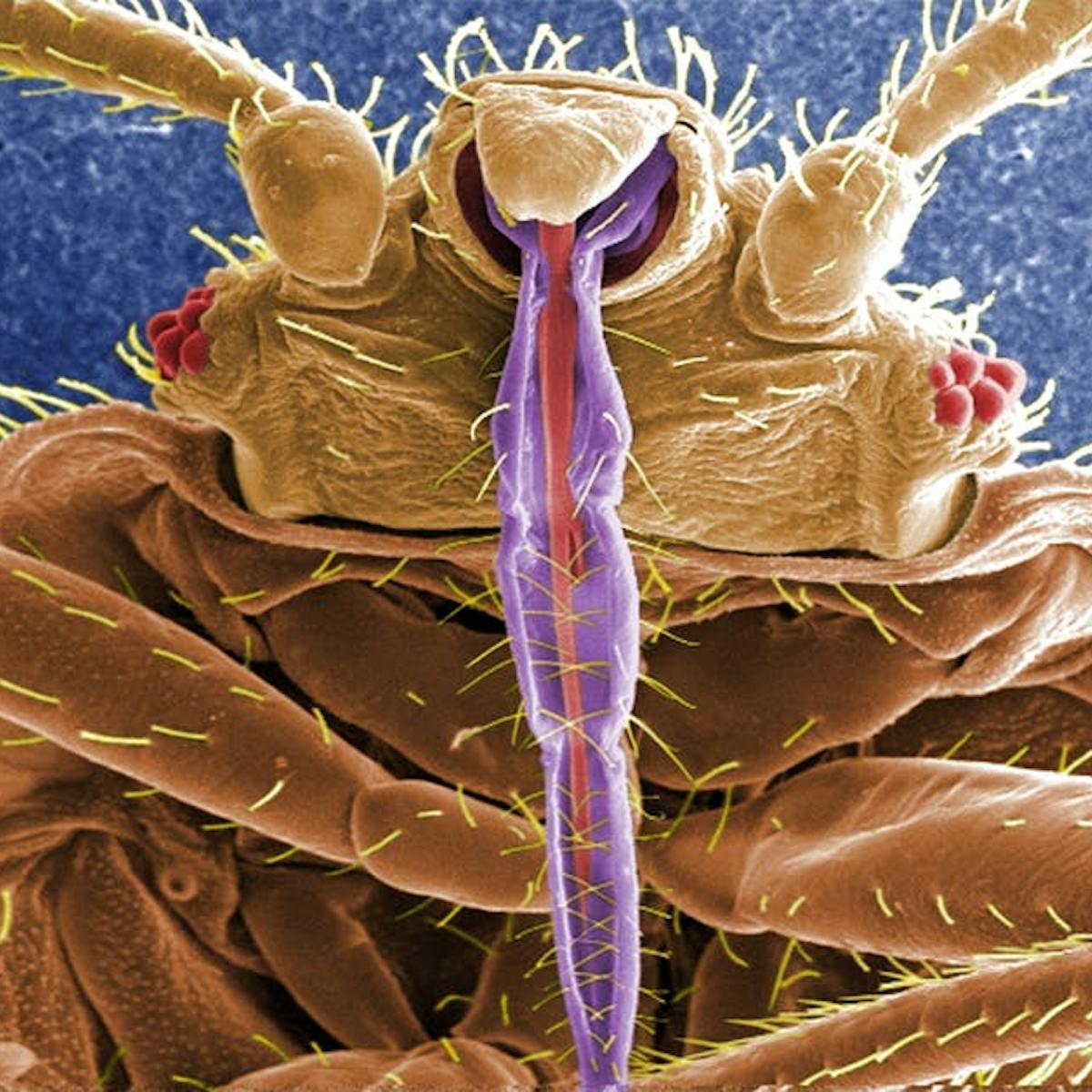 Everything You Never Wanted To Know About Bed Bugs And More