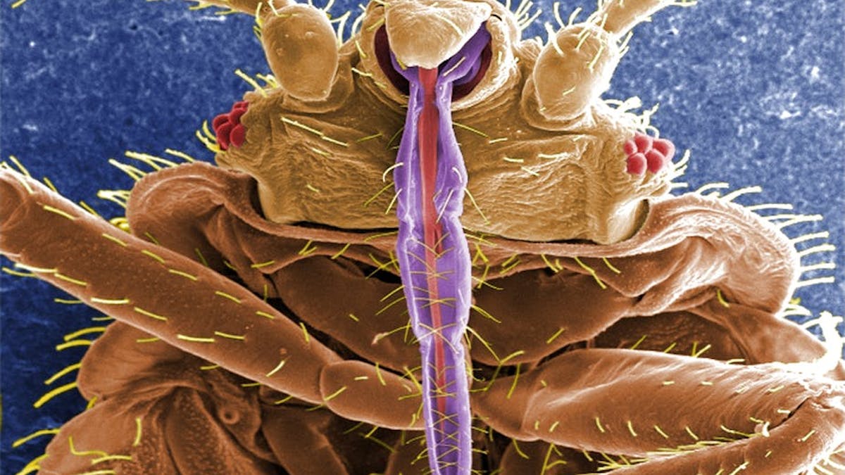 Everything You Never Wanted To Know About Bed Bugs And More