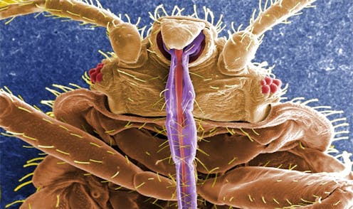 Everything You Never Wanted To Know About Bed Bugs And More