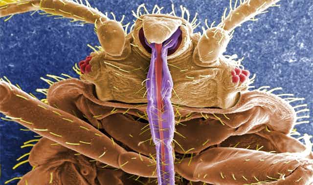 Awesomepest Bed Bug Exterminator Dallas Llc
