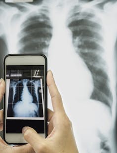 Doctors already use phones to share clinical images of patients - legislation needs to catch up