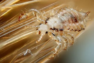 Head Lice Infestations Don T Let Back To School Bloodsuckers
