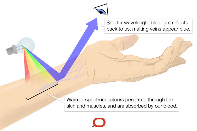 I've always wondered: why do our veins look blue when our blood is red?