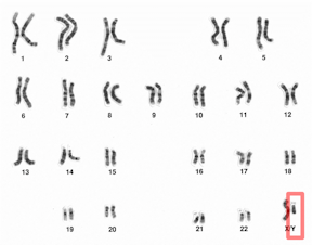 Chromosome Y in red, next to the much larger X chromosome. Credit: National Human Genome Research Institute