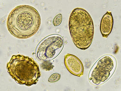 Telur cacing mencemari lalapan salad Menular dan Telur cacing mencemari lalapan salad Menular dan