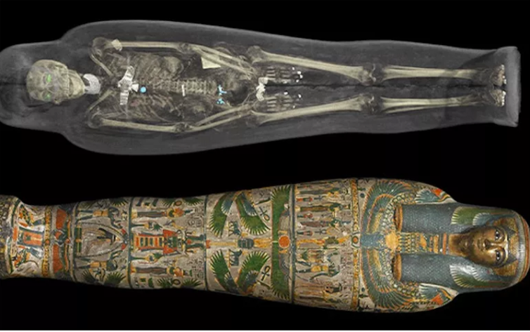 A computed tomography (CT) scan of an ancient Egyptian mummy. - British Museum