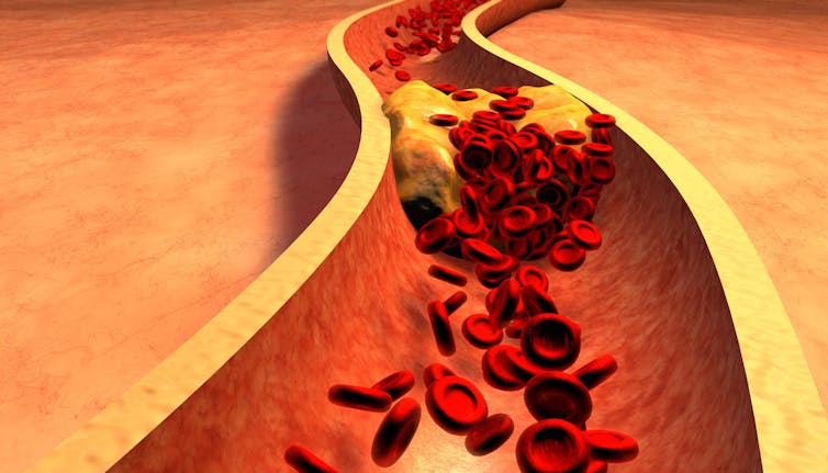 can find cholesterol test