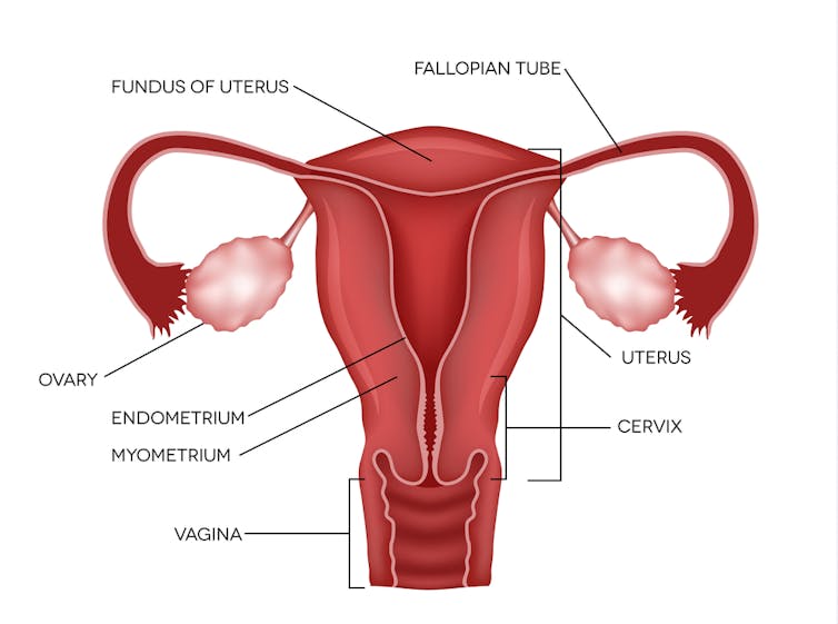 MRKH syndrome, when a woman's uterus never develops