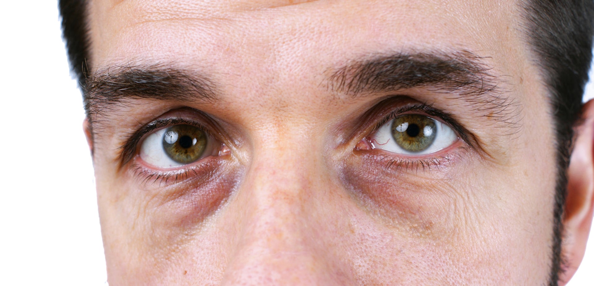 5 Reasons Guys Get Bags Under Their Eyes and How to Get Rid of Them   PrettyBoy