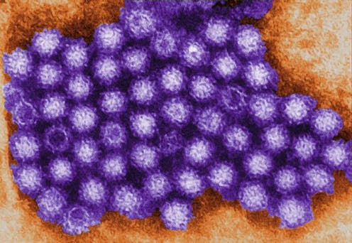 Why is there a norovirus outbreak at the Winter Olympics? 4 questions answered