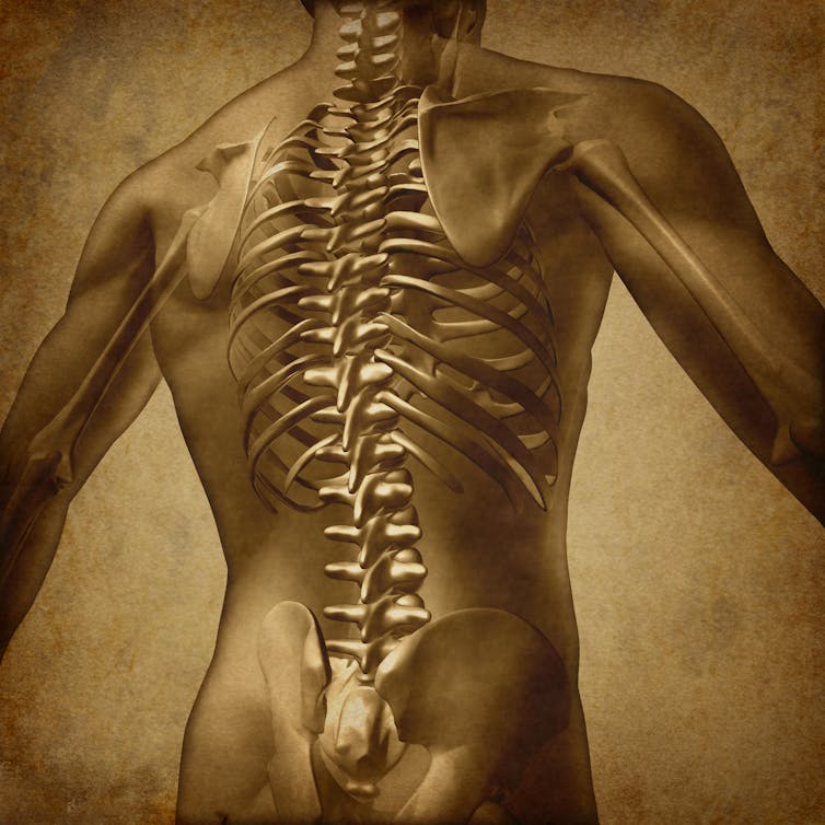 Spinal fusion surgery for lower back pain: it's costly and there's little evidence it'll work