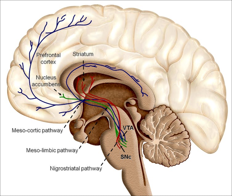 How your brain is wired to just say ‘yes’ to opioids