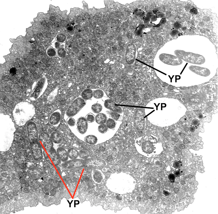 Plague bacteria may be hiding in common soil or water microbes, waiting to emerge