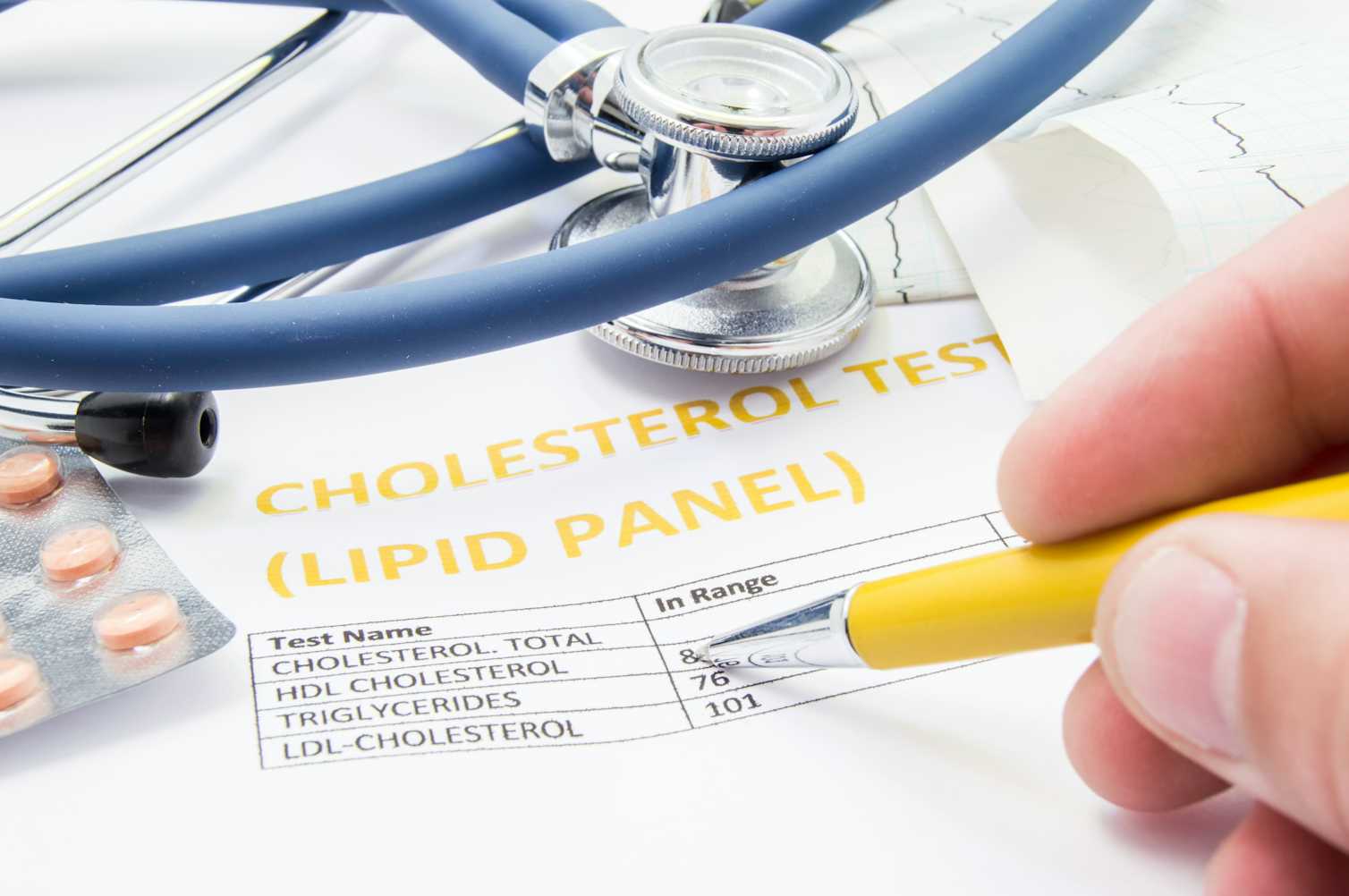 Can having high cholesterol reduce your chances of dementia?