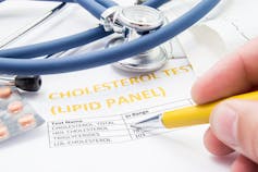 how does learning and memory use cholesterol
